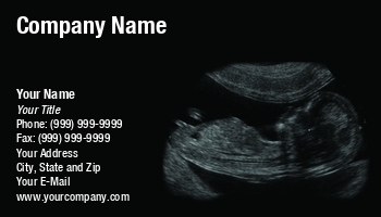Featured Designs |--| At121451 | Cindy Farmer | Fetus | Image | Medicine | Ob Gyn | Obstetrician | Radiology | Sonogram | Sonography | Ultrasonography | Ultrasound | Ultrasound Technician | Used | Womb
